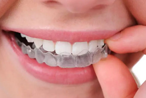 合肥儿童牙齿矫正费用大约多少钱？